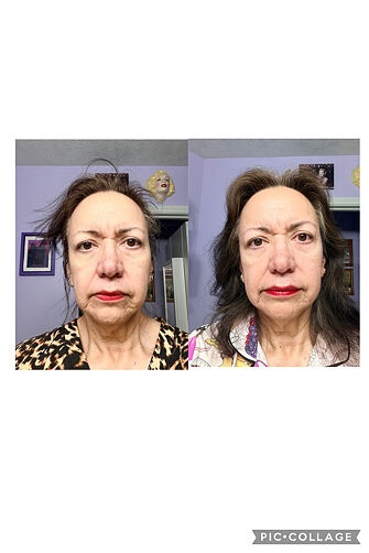 Customer before and after result
